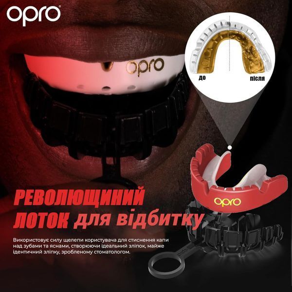 Капа OPRO Gold Braces під брекети доросла (вік 11+) Red/Pearl (art.102506003) DL-98BBB0EFA2 фото